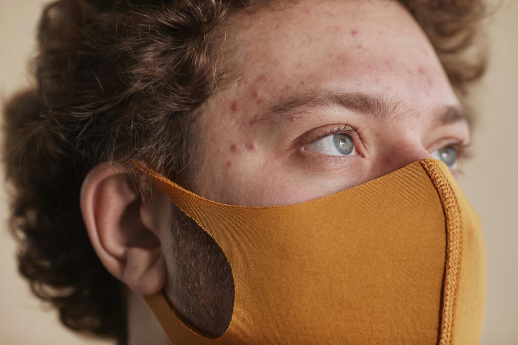 Detailed close-up of a young man man with acne wearing a face mask