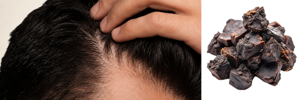 Male scalp showing thinning hair alongside raw shilajit pieces on white background